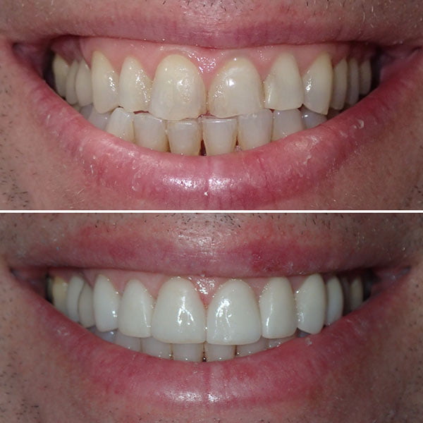 Smile Gallery Image