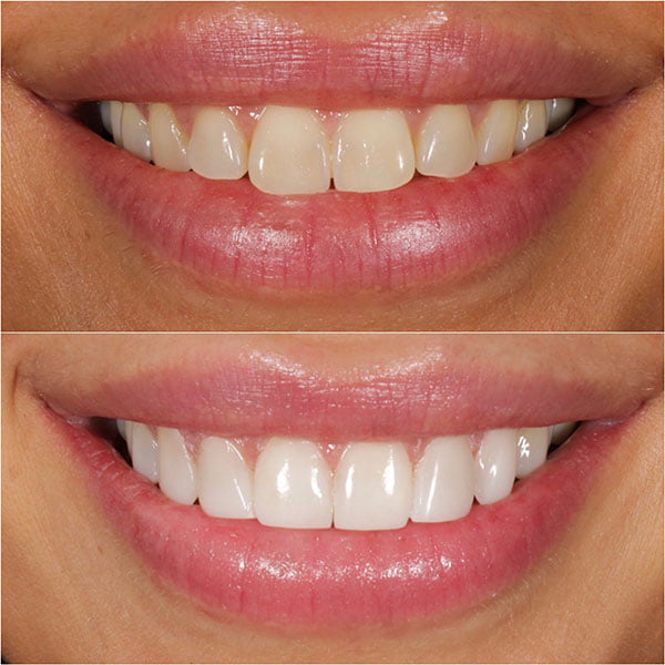 Smile Gallery Image