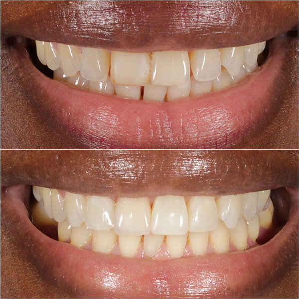 Smile Gallery Image