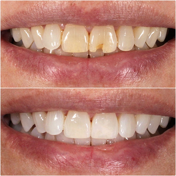 Smile Gallery Image