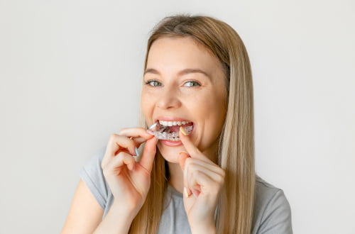 Young woman placing a clear Invisalign aligner on her teeth for orthodontic treatment