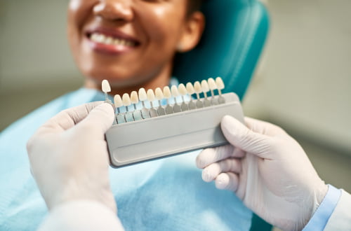 Dentist comparing tooth shade samples during a cosmetic dental consultation in Vaughan for veneers or aesthetic dental procedures