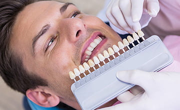 Esthetic Veneer Dentistry in Vaughan