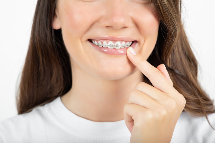 Teeth Contouring & Reshaping in Vaughan
