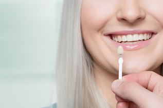 Porcelain vs. Composite Veneers.jpg