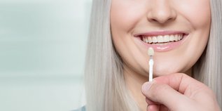 Porcelain vs. Composite Veneers.jpg