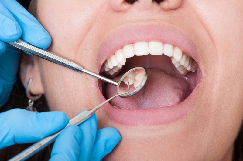 Dentist examining patient’s teeth with dental tools during an oral health checkup