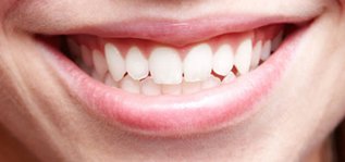 gums-720x340 (1).jpg