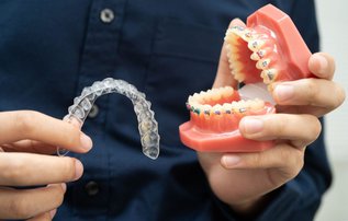 Invisalign aligners and braces