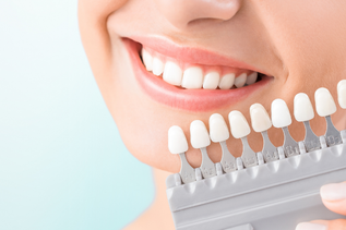 teeth bleaching.png