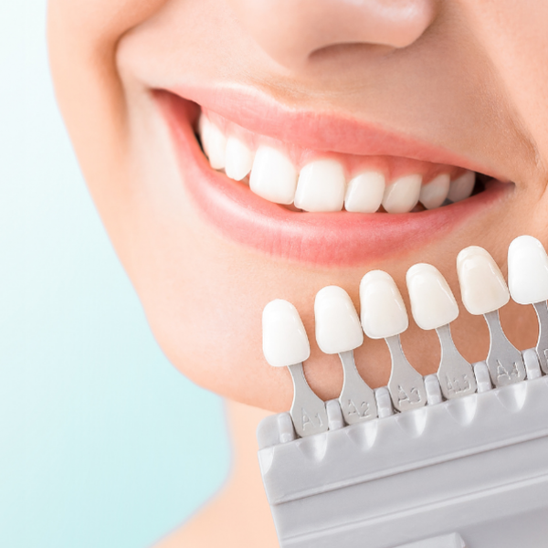 The Definitive Guide to Professional Teeth